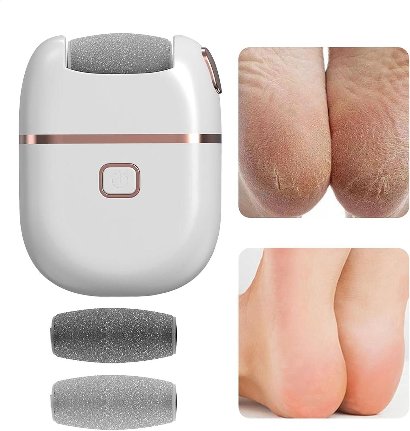 Electronic Callus Remover - Pedicure Tool✨